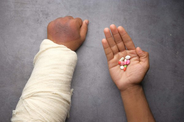 Comment gérer une crise de purpura thrombocytopénique idiopathique ?